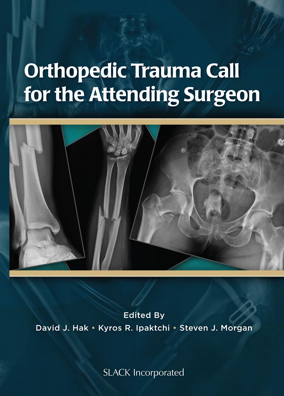 Orthopedic Trauma Call for the Attending Surgeon(Repost) by David J. Hak MD MBA