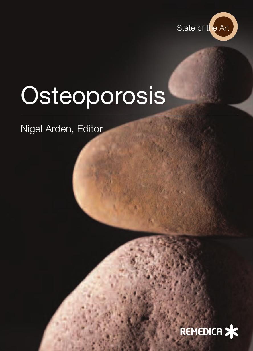 Osteoporosis (Illustrated) by Nigel Arden