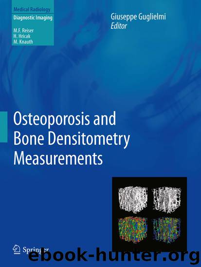 Osteoporosis and Bone Densitometry Measurements by Giuseppe Guglielmi