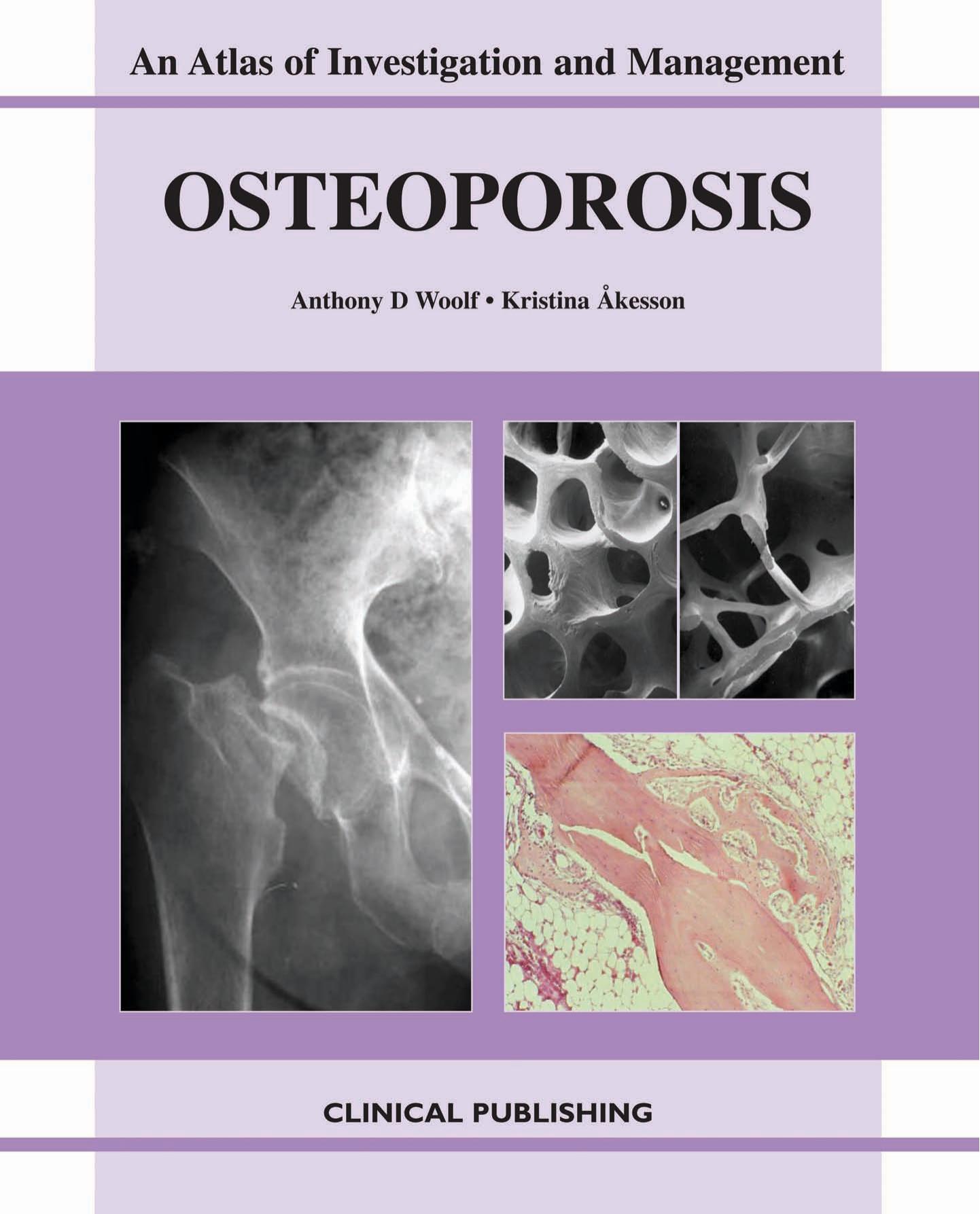 Osteoporosis: An Atlas Of Investigation And Diagnosis by Anthony D. Woolf Kristina Akesson