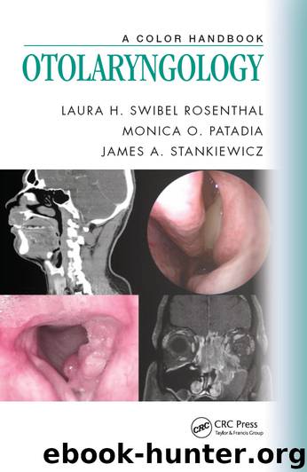 Otolaryngology by Laura H. Swibel Rosenthal Monica O. Patadia & James A. Stankiewicz