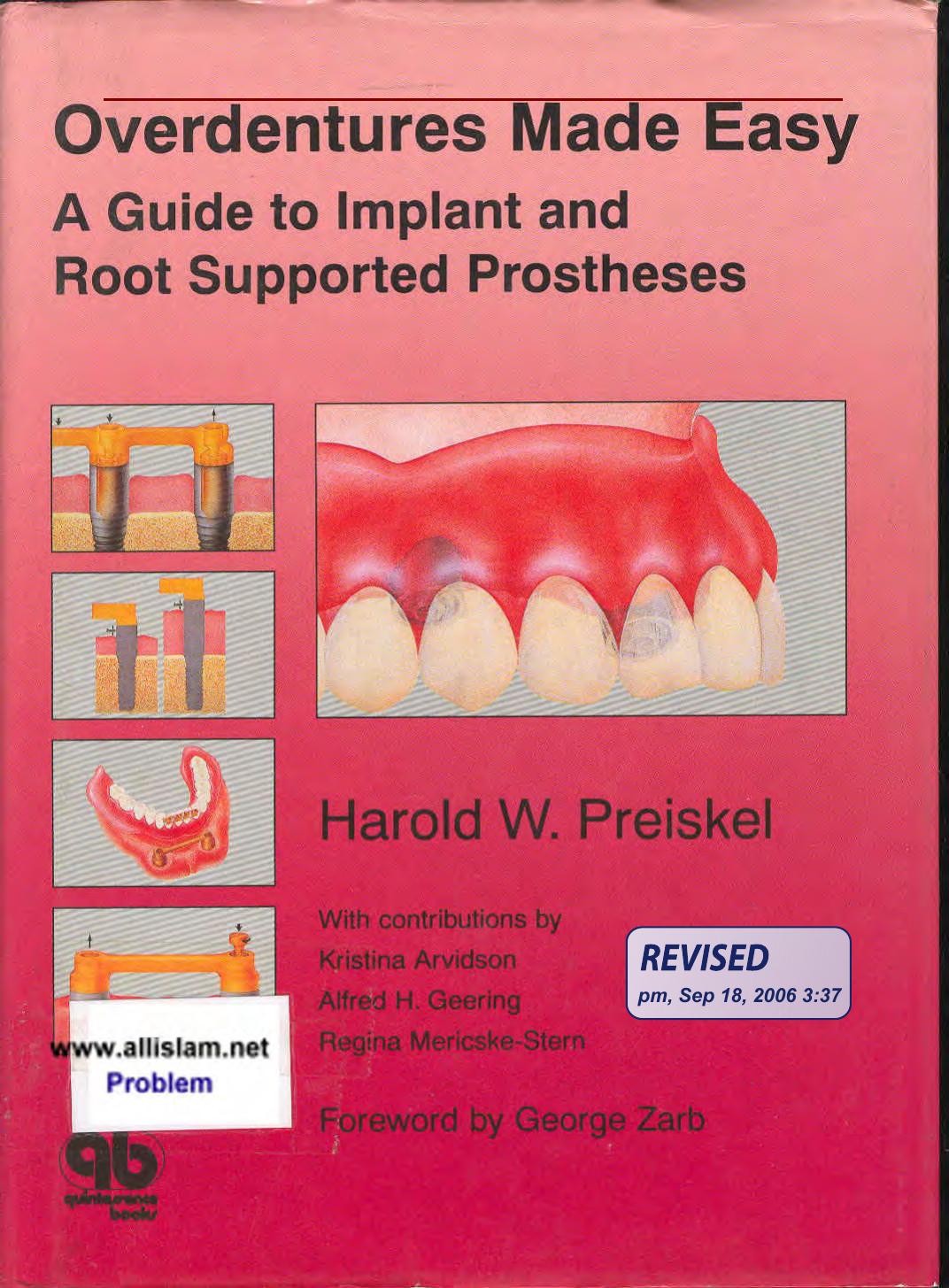Overdentures made easy a guide to implant and root supported prostheses by Preiskel Harold W