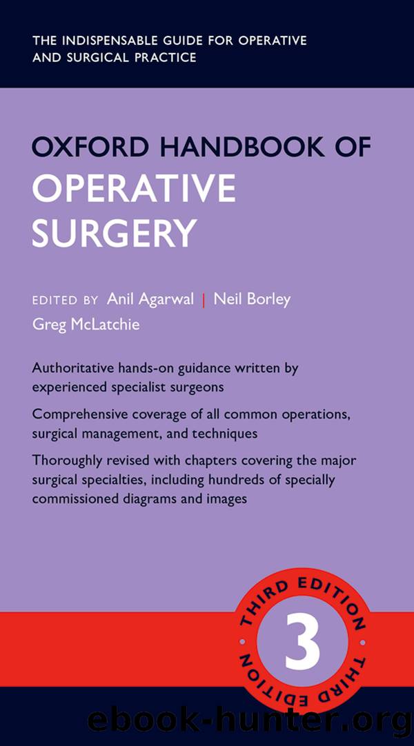 Oxford Handbook of Operative Surgery by Agarwal Anil; Borley Neil; McLatchie Greg