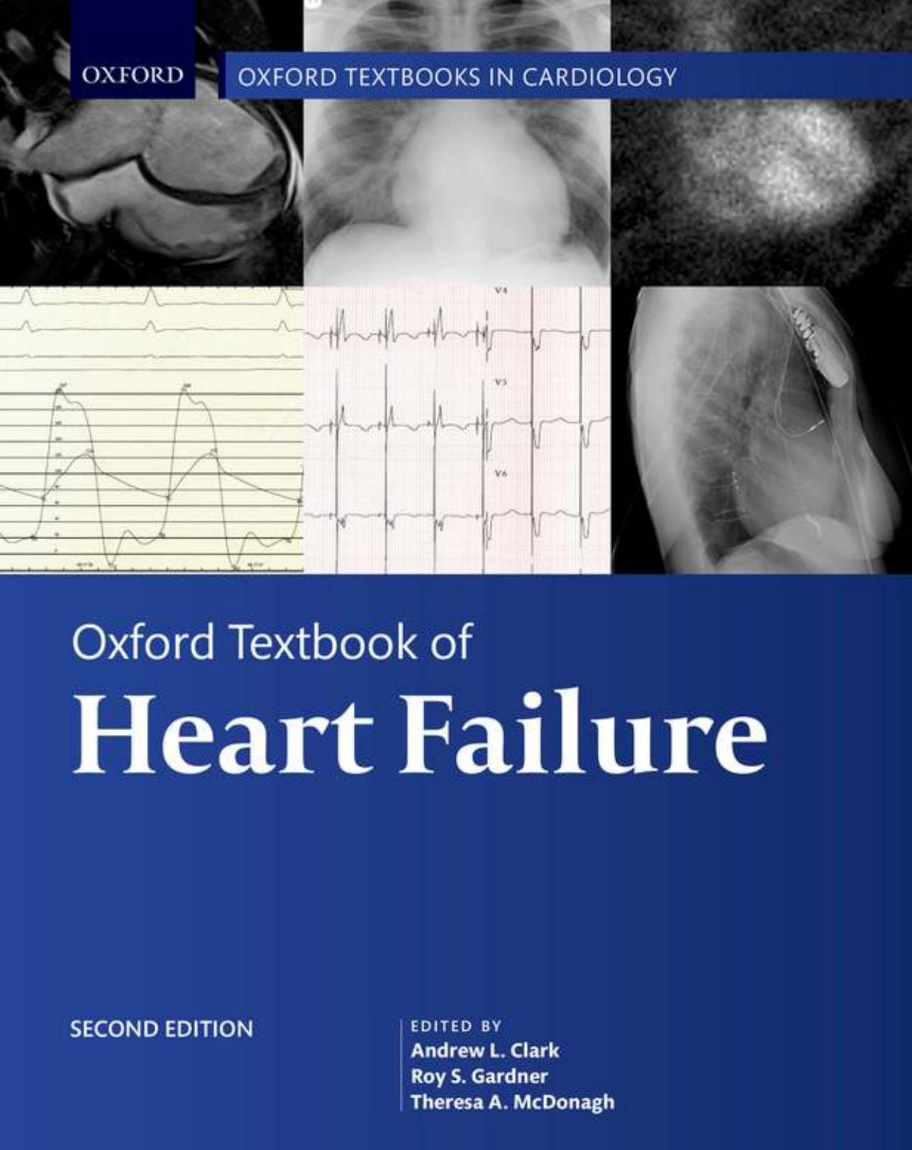 Oxford Textbook of Heart Failure (Oxford Textbooks in Cardiology) [Team-IRA] (True PDF_ by Andrew L. Clark (editor) Roy S. Gardner (editor) Theresa A. McDonagh (editor)