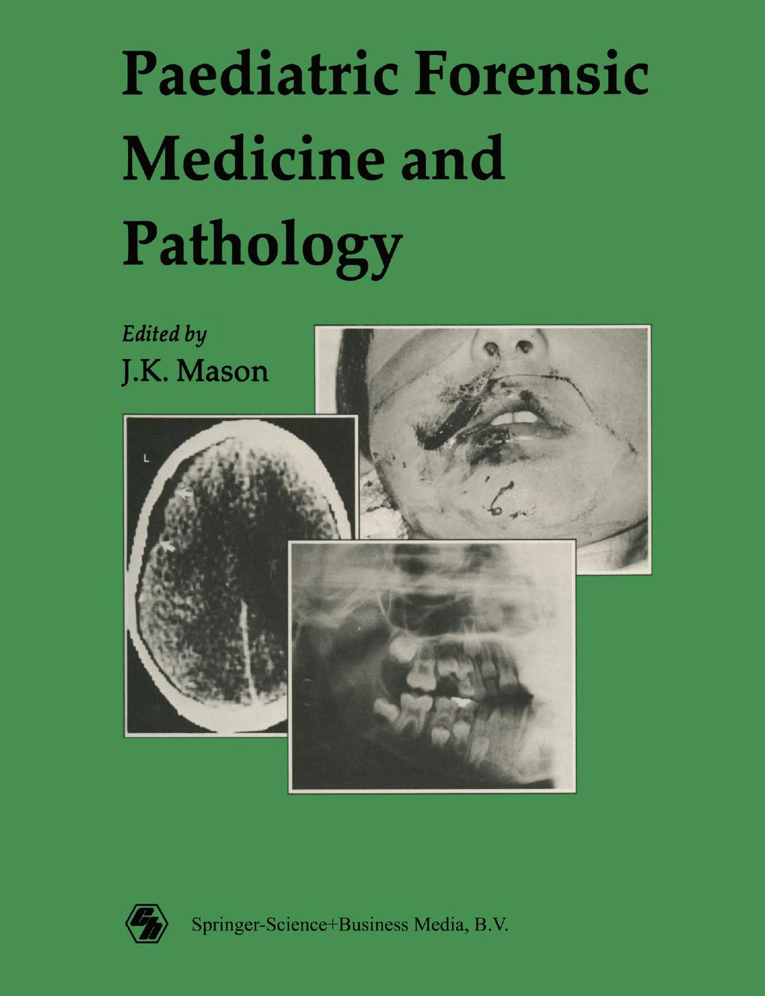 Paediatric Forensic Medicine and Pathology by Cyril H. Wecht Glenn M. Larkin (auth.) J. K. Mason CBE MD LLD FRCPath DMJ (eds.)