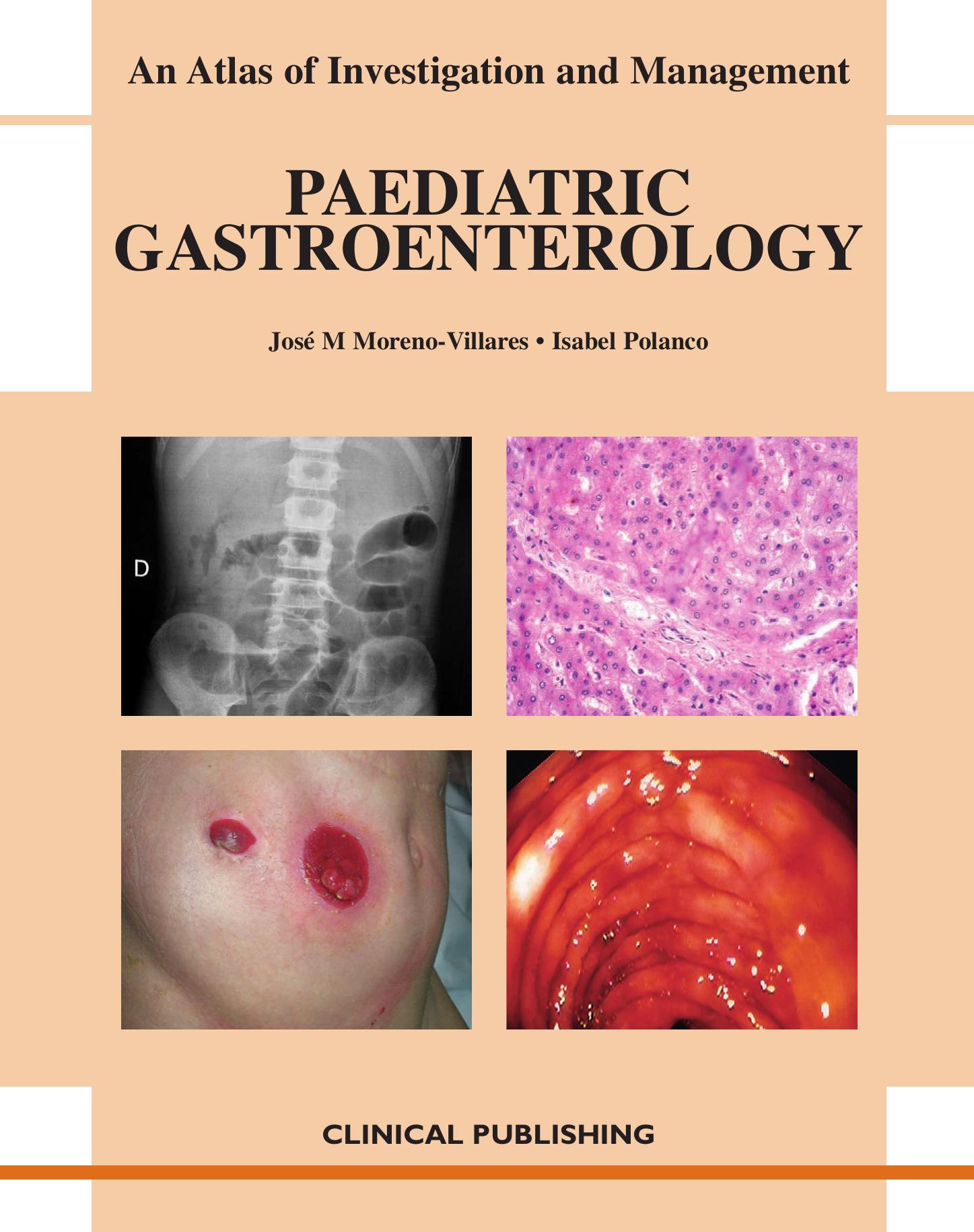 Paediatric Gastroenterology: Atlas of Investigation and Management (Atlases of Investigation and Management) by Jose M. M.D. Moreno-Villares Isabel M.D. Ph.D. Polanco