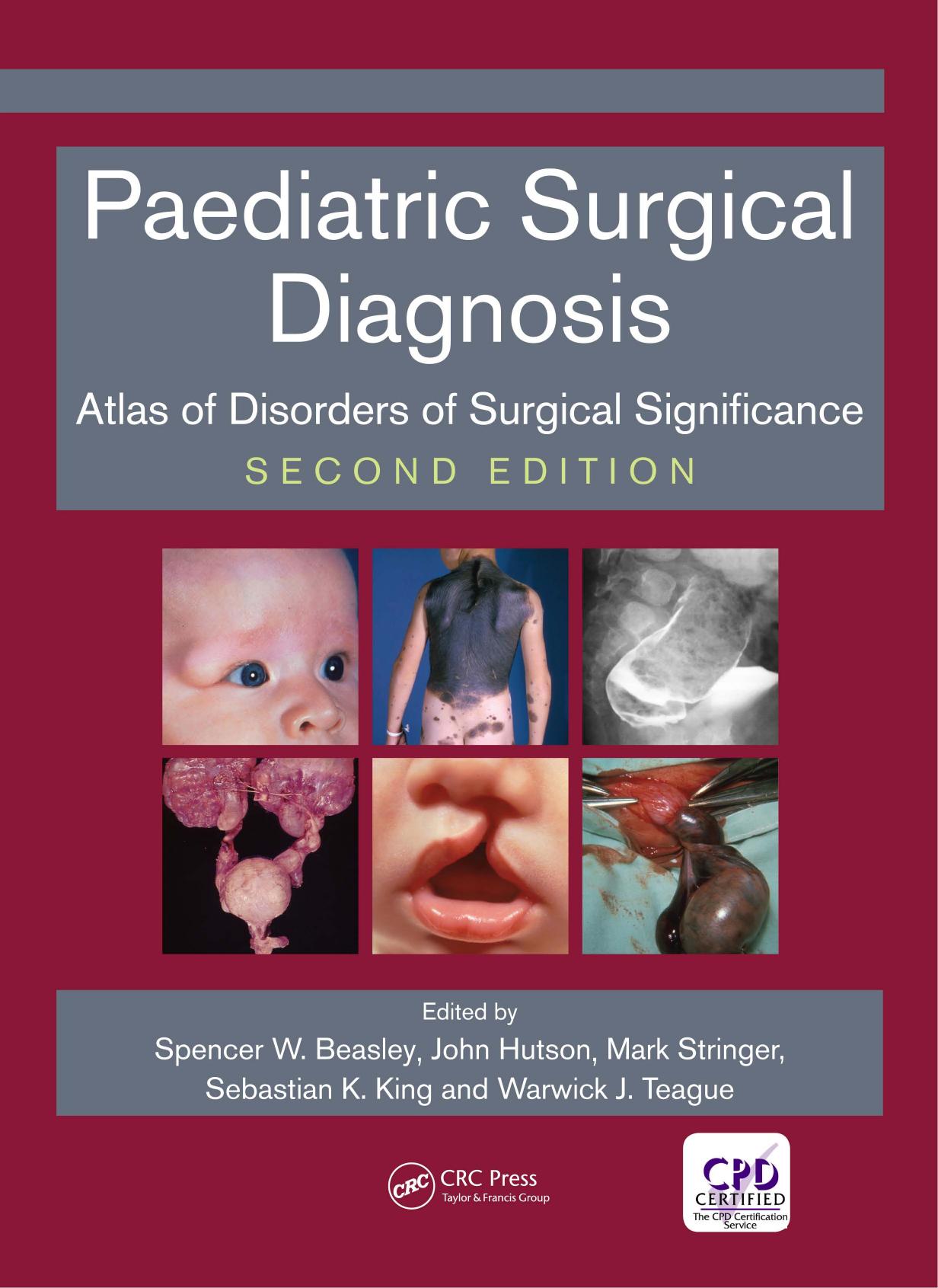 Paediatric Surgical Diagnosis: Atlas of Disorders of Surgical Significance, 2nd Edition by Unknow