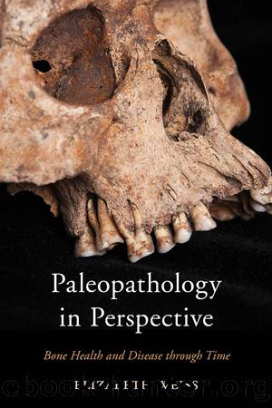 Paleopathology in Perspective by Weiss Elizabeth;