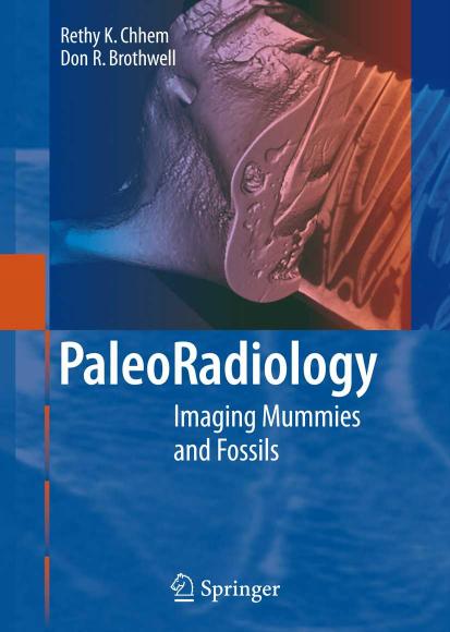 Paleoradiology: Imaging Mummies and Fossils by R.K. Chhem & D.R. Brothwell
