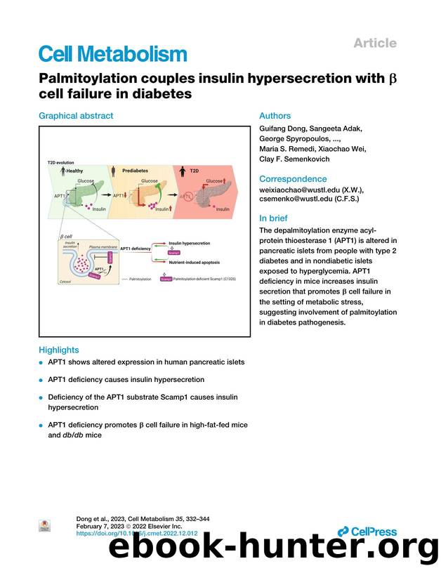 Palmitoylation couples insulin hypersecretion with &beta; cell failure in diabetes by unknow