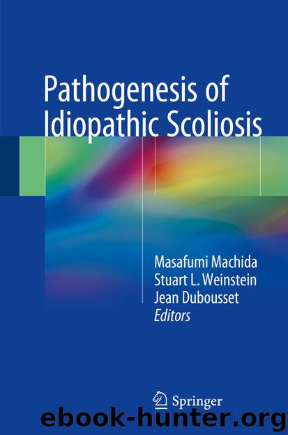 Pathogenesis of Idiopathic Scoliosis by Masafumi Machida Stuart L. Weinstein & Jean Dubousset