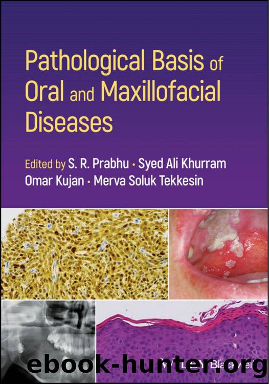 Pathological Basis of Oral and Maxillofacial Diseases by S. R. Prabhu & Syed Ali Khurram & Omar Kujan and Merva Soluk Tekkesin