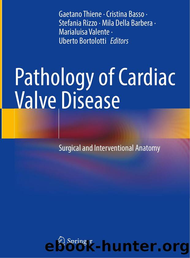 Pathology of Cardiac Valve Disease by Unknown