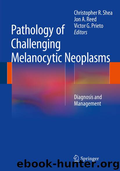 Pathology of Challenging Melanocytic Neoplasms by Christopher R. Shea Jon A. Reed & Victor G. Prieto