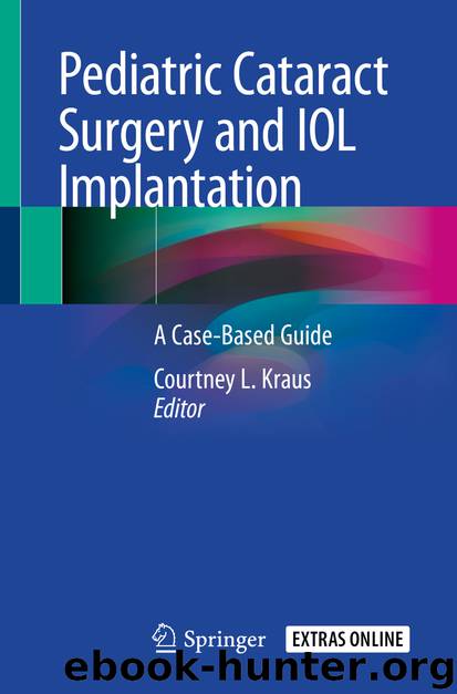Pediatric Cataract Surgery and IOL Implantation by Unknown