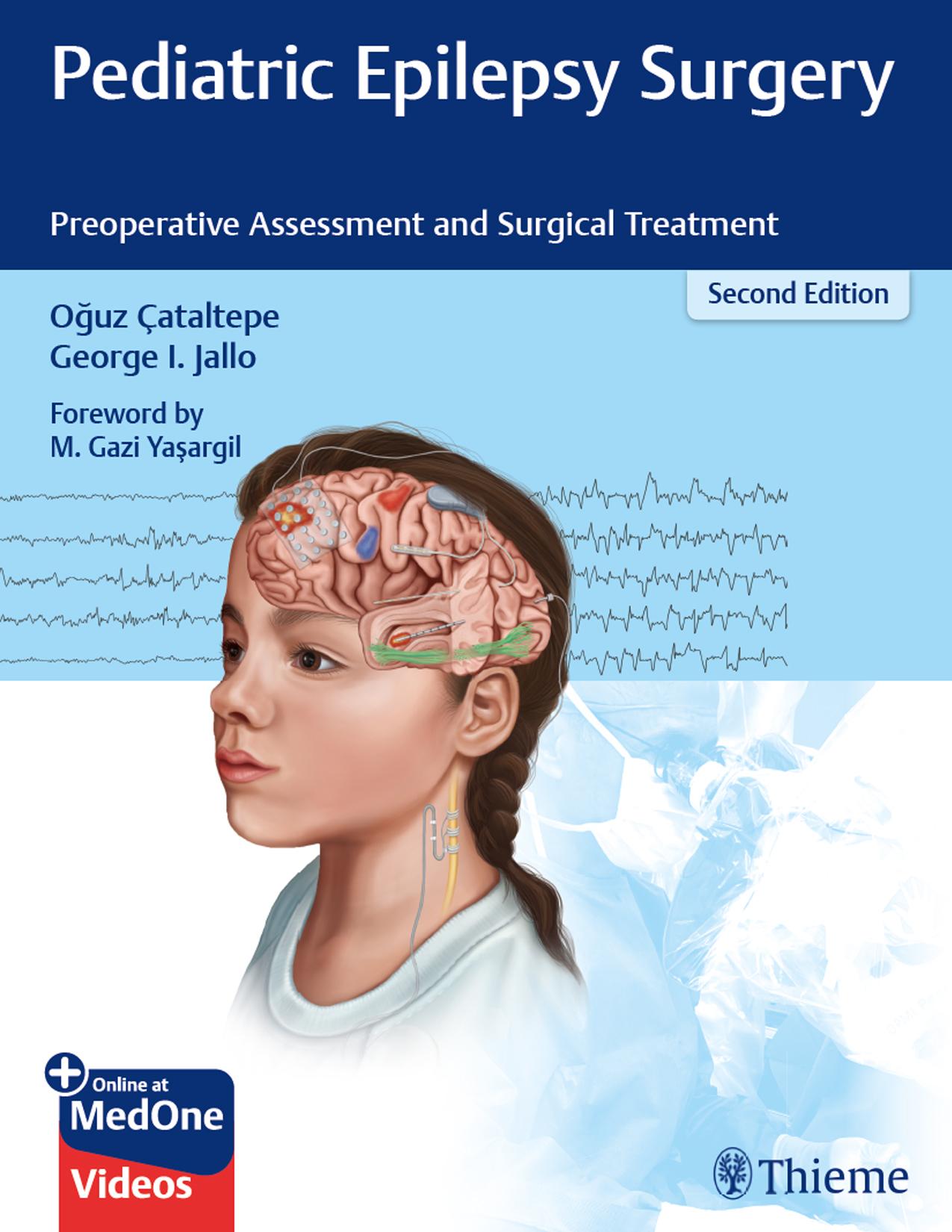 Pediatric Epilepsy Surgery: Preoperative Assessment and Surgical Treatment by Oguz Cataltepe George Jallo