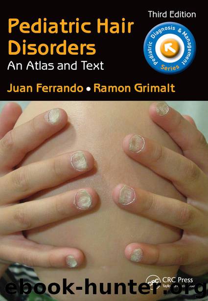 Pediatric Hair Disorders by Juan Ferrando & Ramon Grimalt
