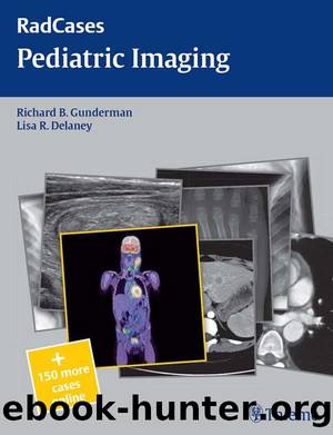Pediatric Imaging (RadCases) by Delaney Lisa & Gunderman Richard