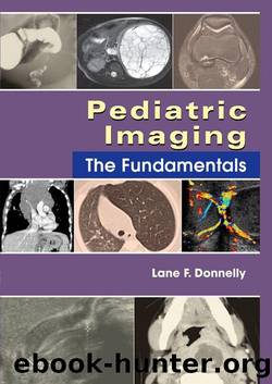 Pediatric Imaging E-Book: The Fundamentals by Donnelly Lane F