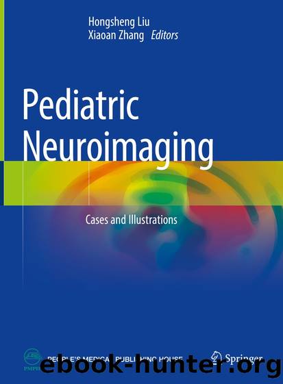 Pediatric Neuroimaging by Unknown