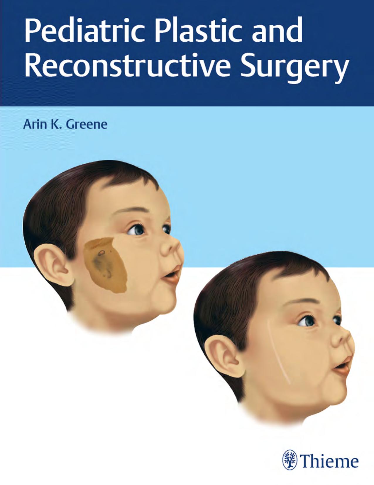 Pediatric Plastic and Reconstructive Surgery by Arin K. Greene