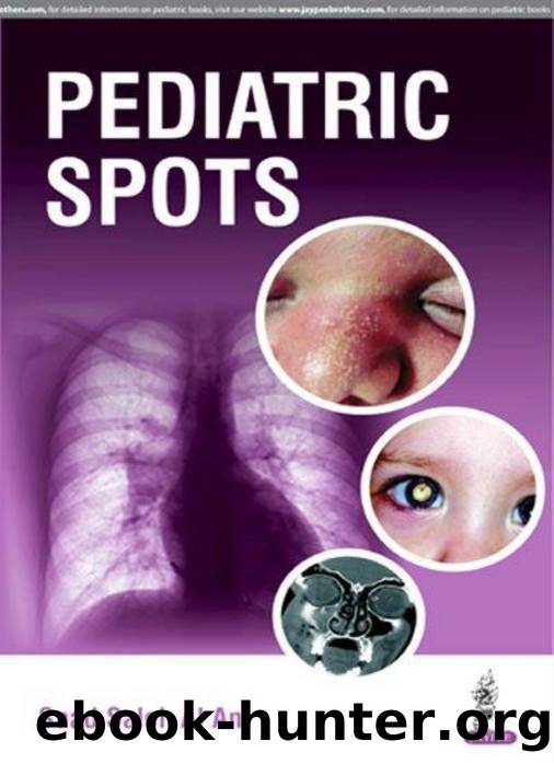 Pediatric Spots by Saad Saleh Al Ani