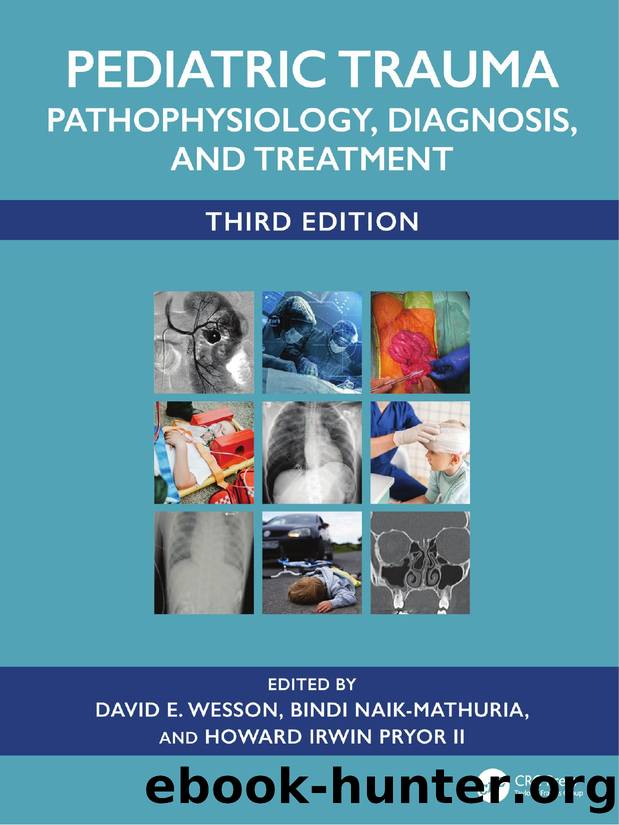 Pediatric Trauma: Pathophysiology, Diagnosis, and Treatment by Edited by David E. Wesson Bindi Naik-Mathuria and Howard Irwin Pryor II