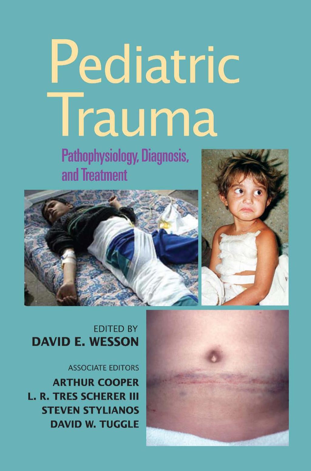 Pediatric Trauma: Pathophysiology, Diagnosis, and Treatment by unknow