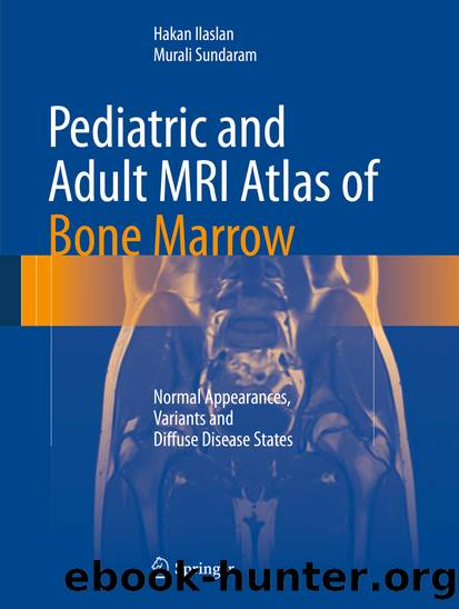 Pediatric and Adult MRI Atlas of Bone Marrow by Hakan Ilaslan & Murali Sundaram
