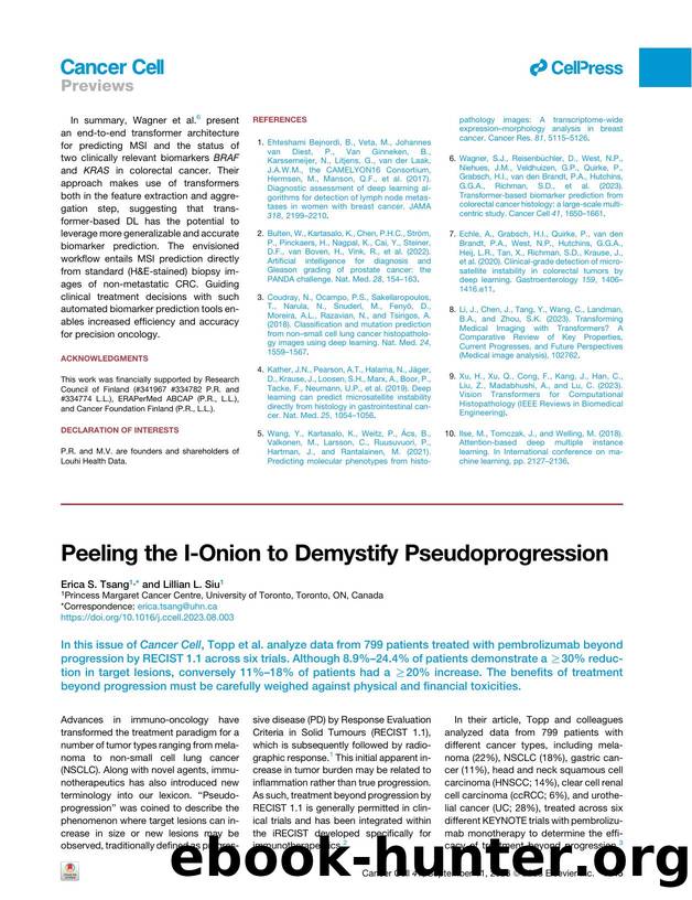 Peeling the I-Onion to Demystify Pseudoprogression by Erica S. Tsang & Lillian L. Siu