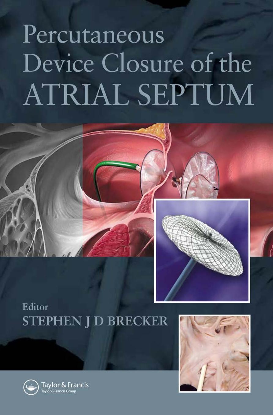 Percutaneous Device Closure of the Atrial Septum by Chris Lear