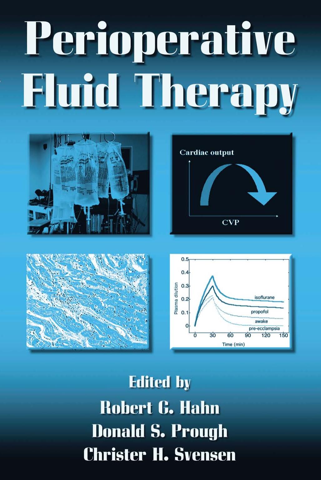 Perioperative Fluid Therapy by Robert G. Hahn Donald S. Prough Christer H. Svensen