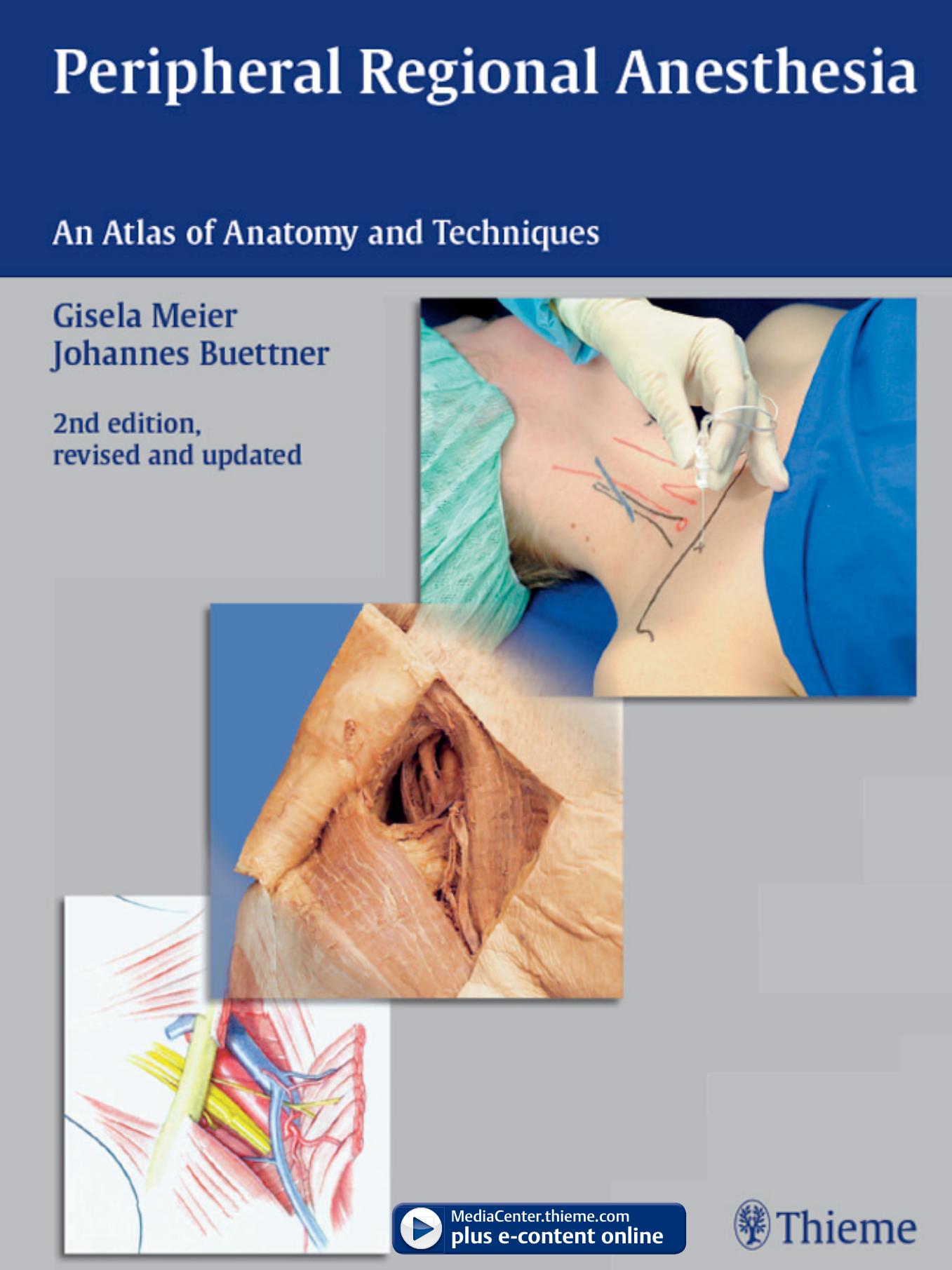 Peripheral Regional Anesthesia: An Atlas of Anatomy and Techniques by Gisela Meier Johannes Buettner
