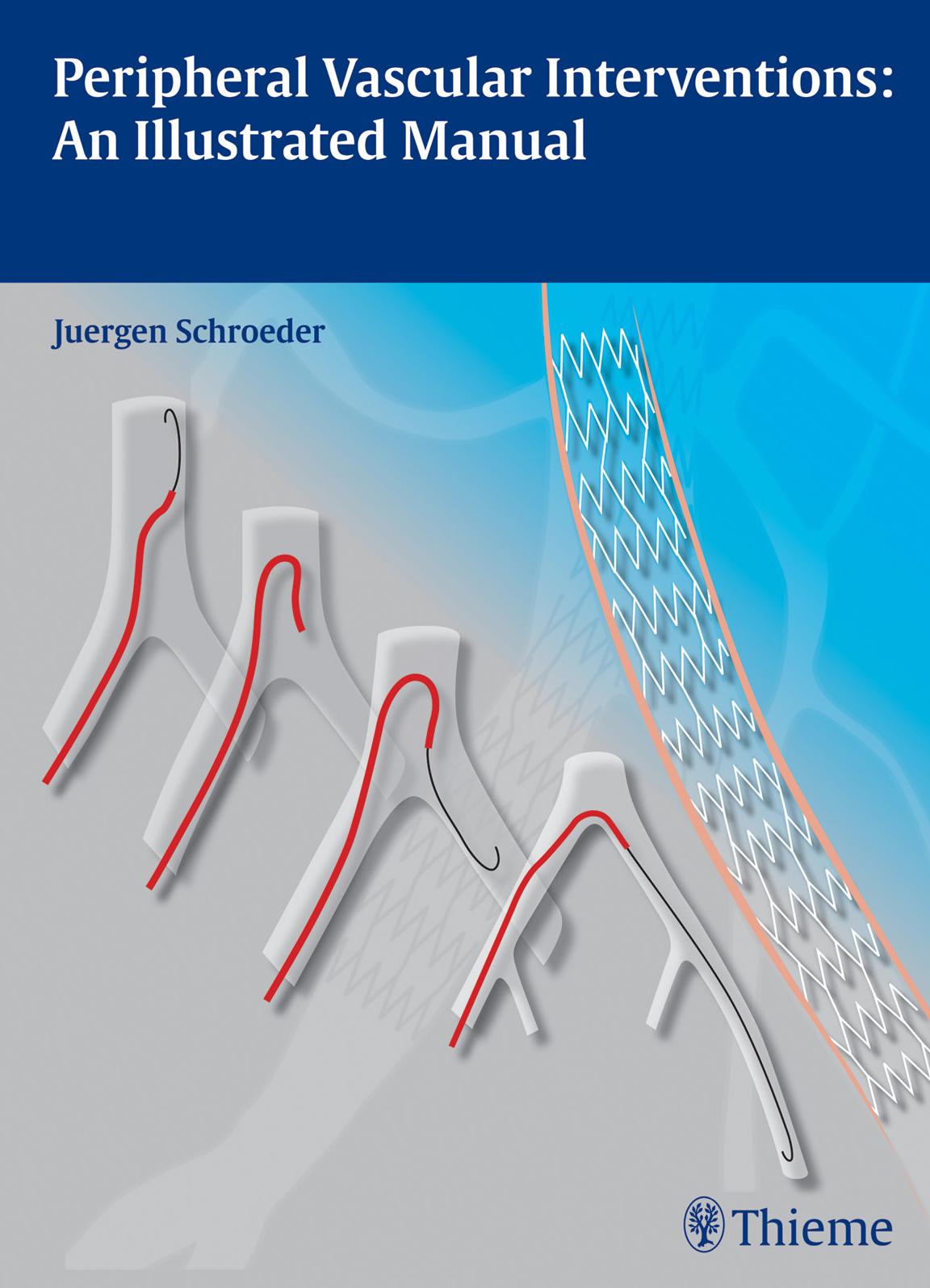 Peripheral Vascular Interventions: An Illustrated Manual by Unknow
