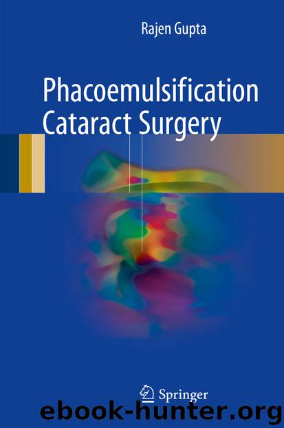 Phacoemulsification Cataract Surgery by Rajen Gupta