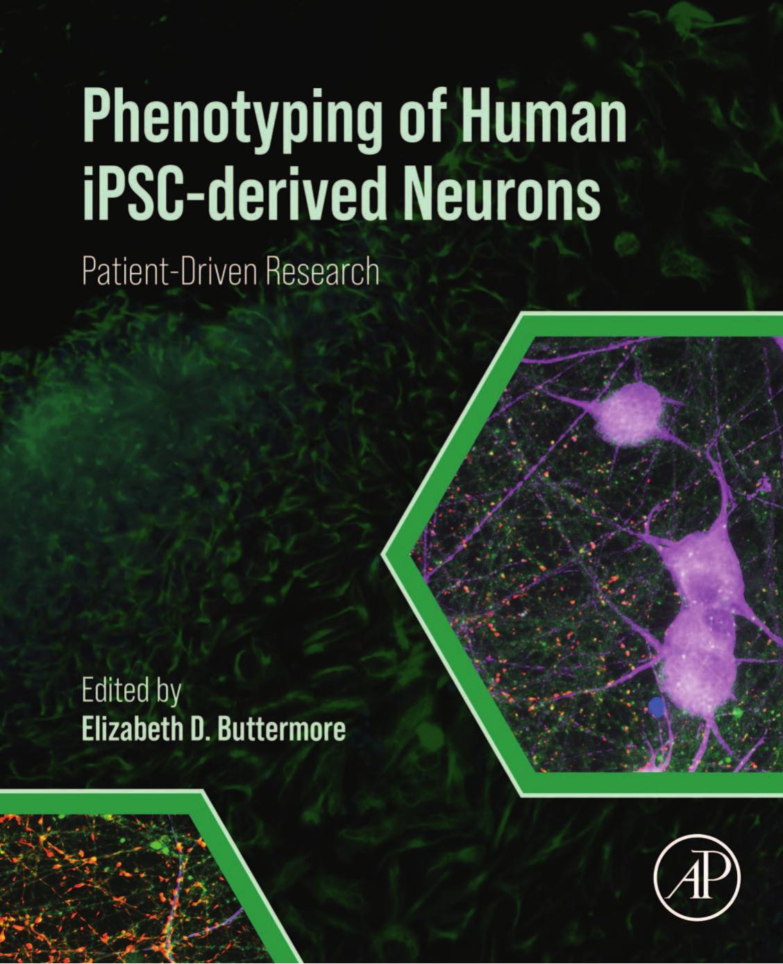 Phenotyping of Human iPSC-derived Neurons: Patient-Driven Research by Elizabeth D. Buttermore