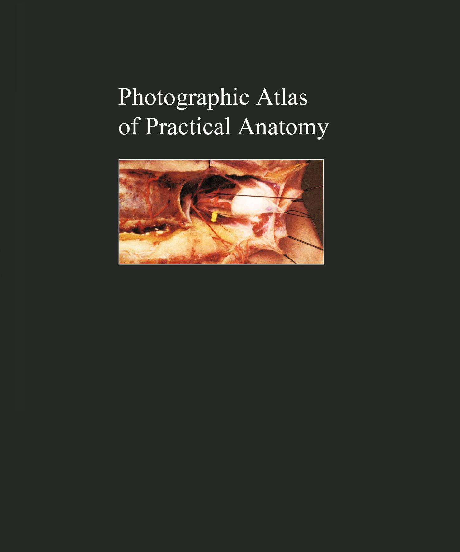 Photographic Atlas of Practical Anatomy II: Neck Â· Head Â· Back Â· Chest Â· Upper Extremities Companion Volume Including Nomina Anatomica and Index by Prof. Dr. Walter Thiel (auth.)