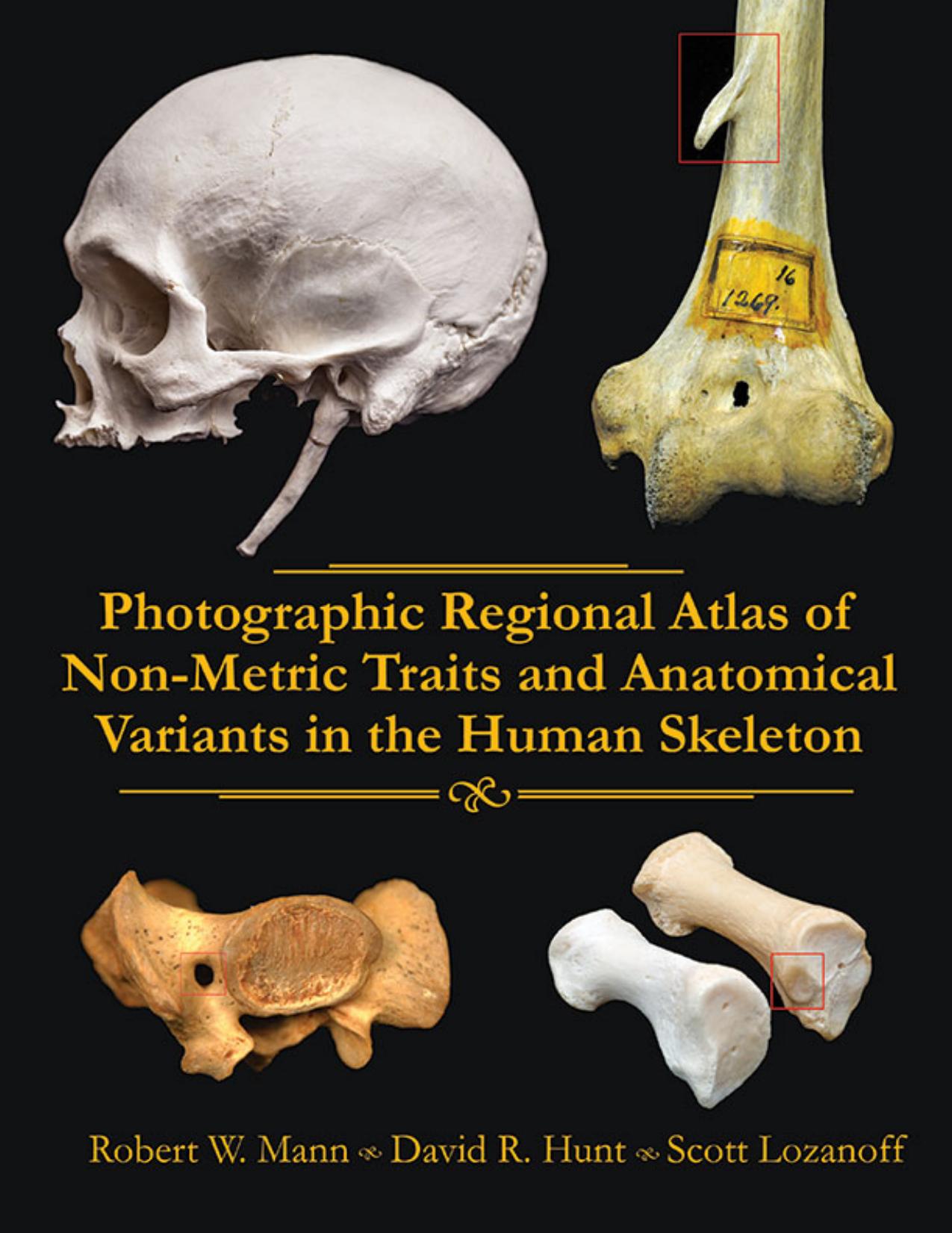 Photographic Regional Atlas of Non-metric Traits and Anatomical Variants in the Human Skeleton by Robert W. Mann and David R. Hunt