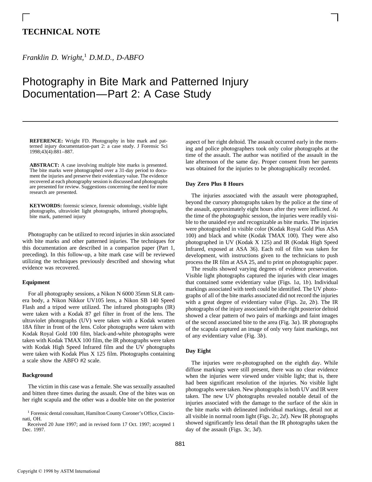 Photography in bite mark and patterned injury documentationÅpart 2: a case study by Wright FD