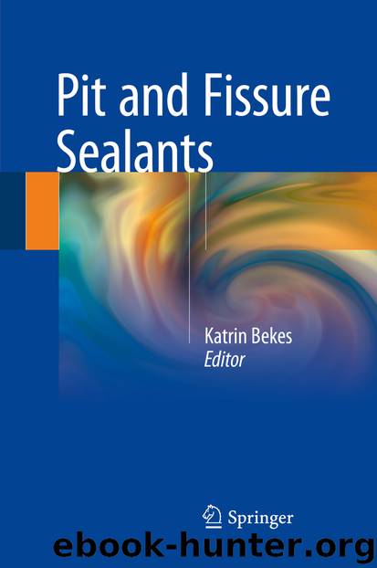 Pit and Fissure Sealants by Katrin Bekes