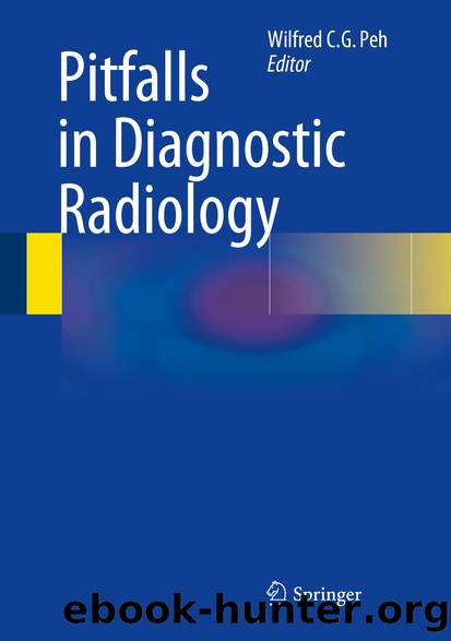Pitfalls in Diagnostic Radiology by Wilfred C. G. Peh