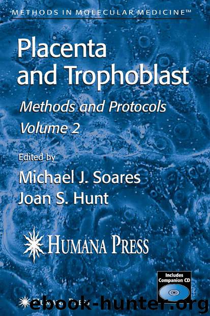 Placenta and Trophoblast by Michael J. Soares & Joan S. Hunt