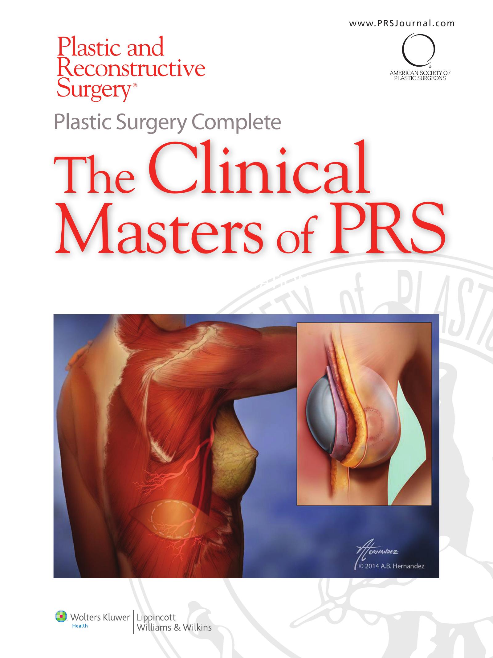 Plastic Surgery Complete: The Clinical Masters of PRS: Breast Augmentation by Rod J. Rohrich