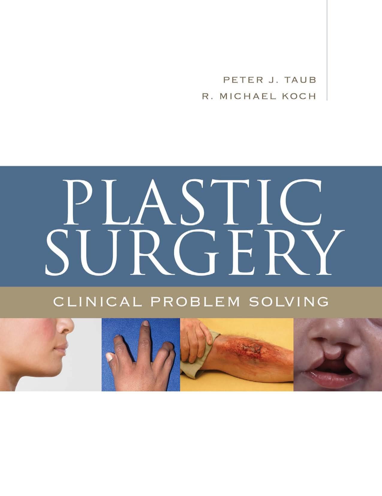 Plastic Surgery: Clinical Problem Solving by Peter Taub R. Michael Koch
