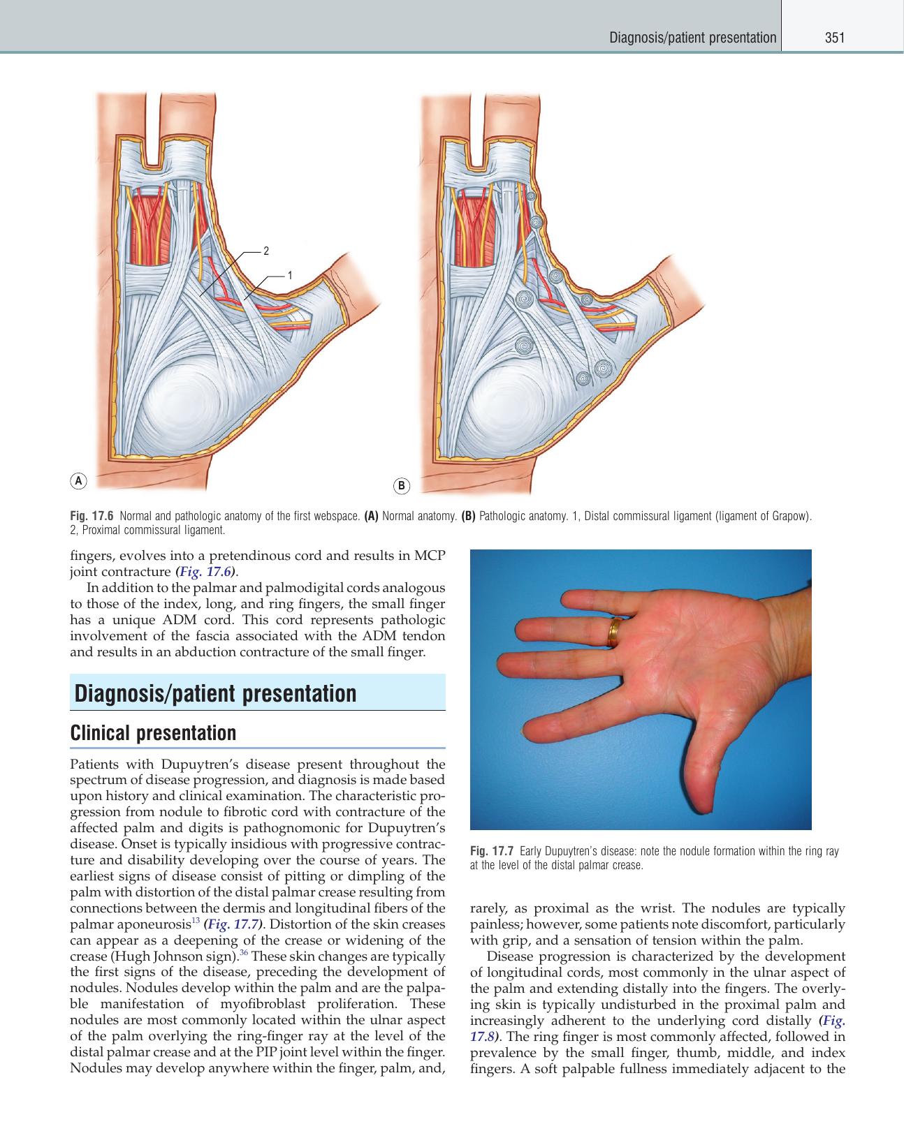 Plastic Surgery. Volume 6. Hand. Part 2 by Neligan P