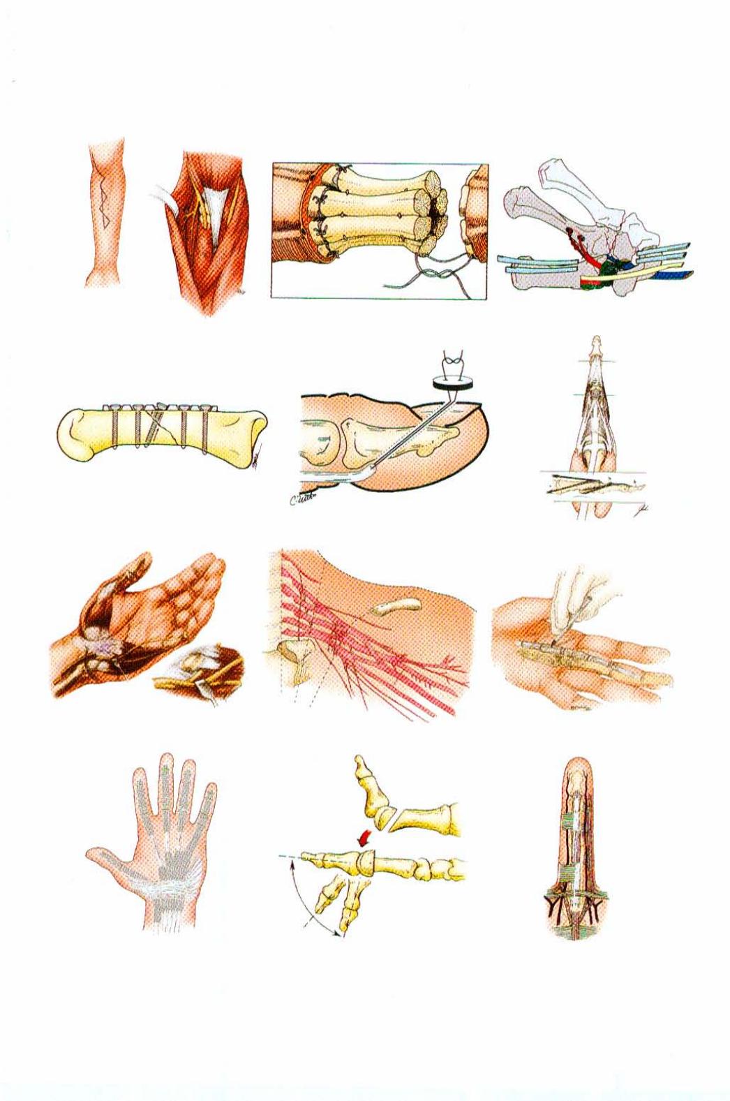 Plastic surgery Vol. 7, The hand Part 1. by J William Littler; Joseph G. McCarthy; James W. May