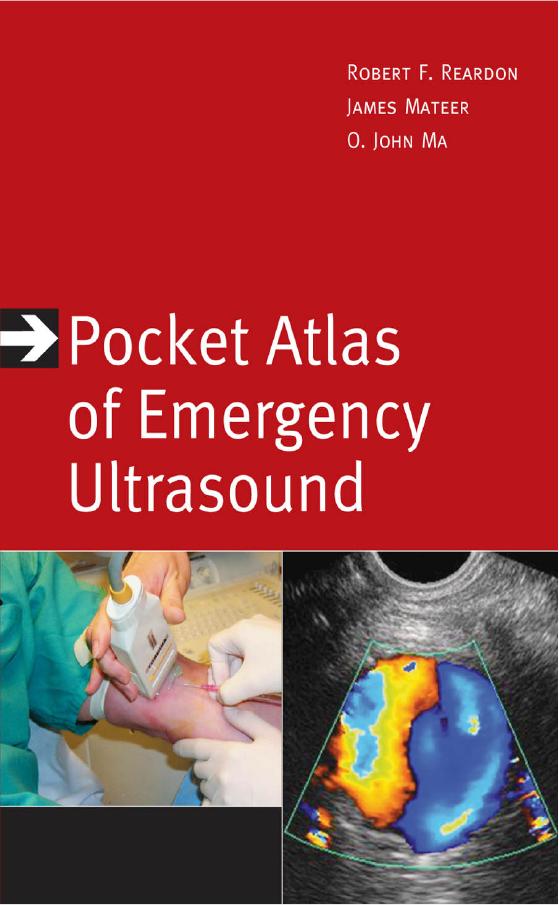 Pocket Atlas of Emergency Ultrasound by Reardon R