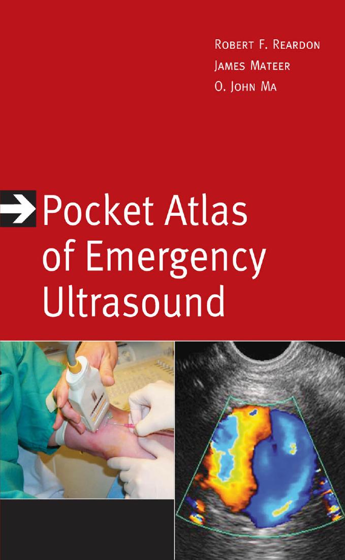 Pocket Atlas of Emergency Ultrasound by Robert F. Reardon; O. John Ma; James R. Mateer