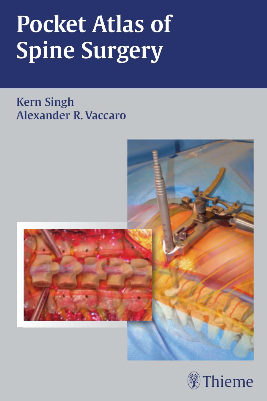 Pocket Atlas of Spine Surgery by Singh Kern