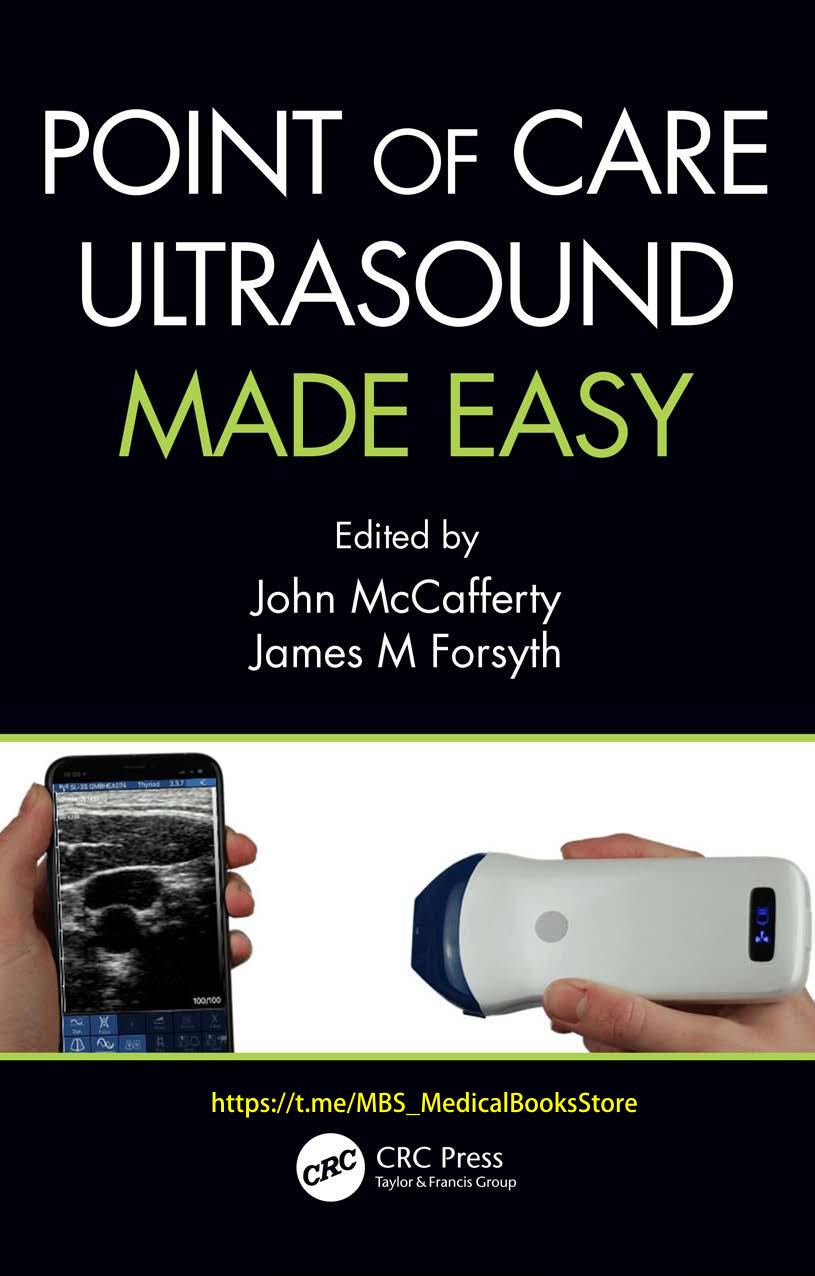 Point of Care Ultrasound Made Easy by John McCafferty James M Forsyth